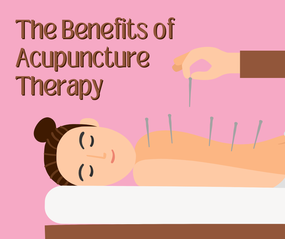 The Benefits Of Acupuncture Therapy Back Pain Insider